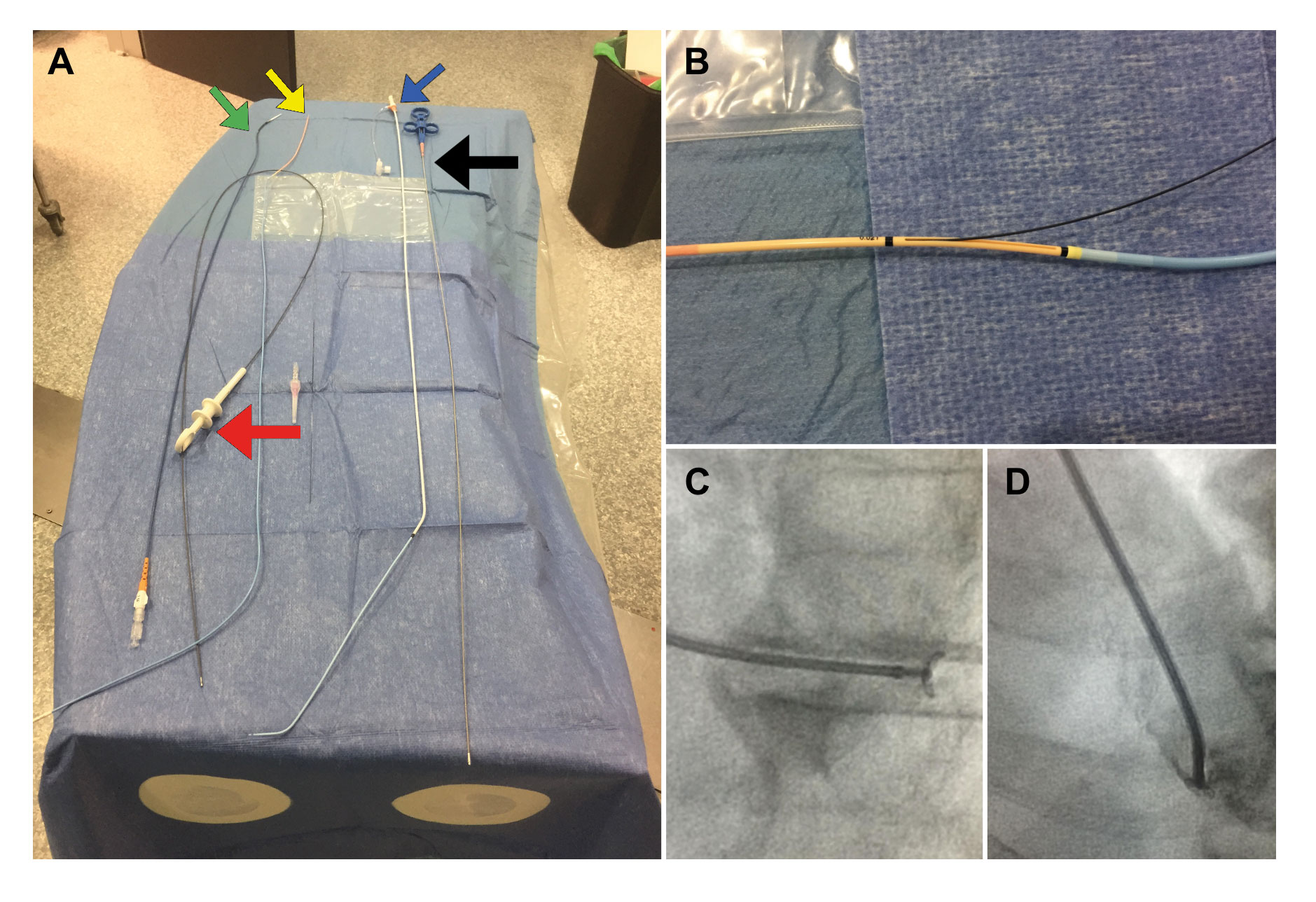 Diagnostic yield and safety profile of endomyocardial biopsy in the non ...