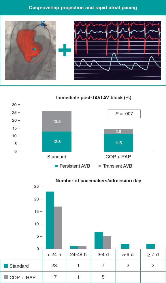 Projection selection and rapid atrial pacing improves early outcomes ...